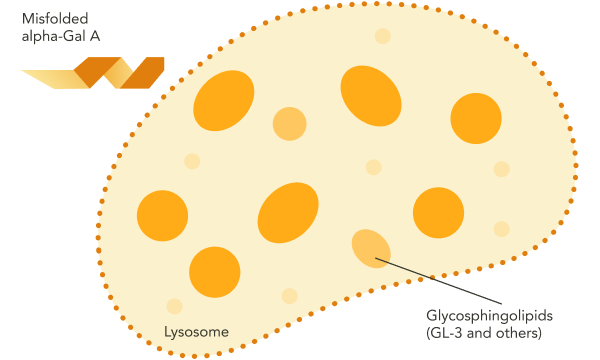 An image of a lysosome with a misfolded alpha-Gal A enzyme leading to an accumulation of glycosphingolipids